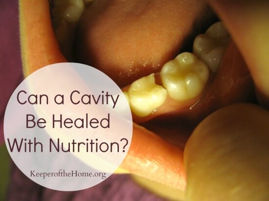 heal-cavity-with-nutrition